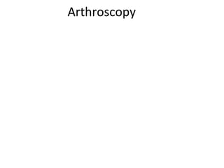Arthroscopy
 