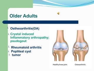 Older Adults
Ostheoarthritis(OA)

Crystal induced
Inflammatory arthropathy; gout,
psudogout

Rheumatoid arthritis
Popliteal cyst
tumor



 