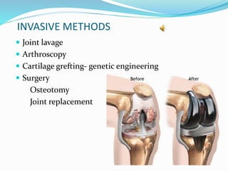INVASIVE METHODS
 Joint lavage
 Arthroscopy
 Cartilage grefting- genetic engineering
 Surgery
Osteotomy
Joint replacement
 