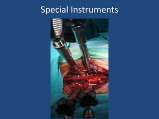 Special Instruments
 
