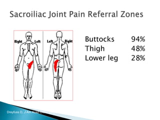 Buttocks 94%
Thigh 48%
Lower leg 28%
Dreyfuss D, J Am Acad Ortho Surg 2004, 12.
 