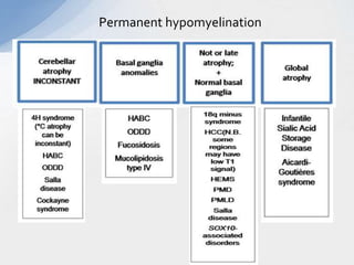 Permanent hypomyelination
 
