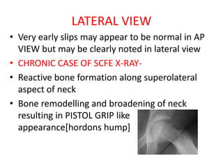 COMPLICATIONS
1. Avascular necrosis.
2. Chondrolysis.
3. Secondary Osteoarthritis.
4. Coxa vara (is a deformity of the hip...