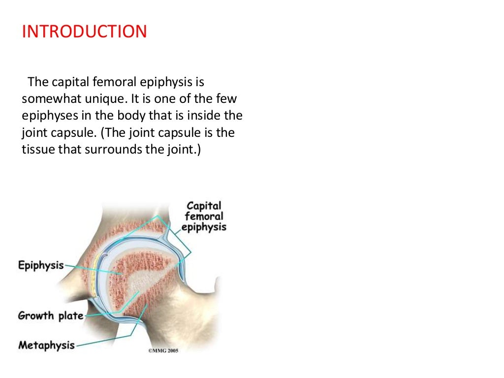 Approach to limping child
