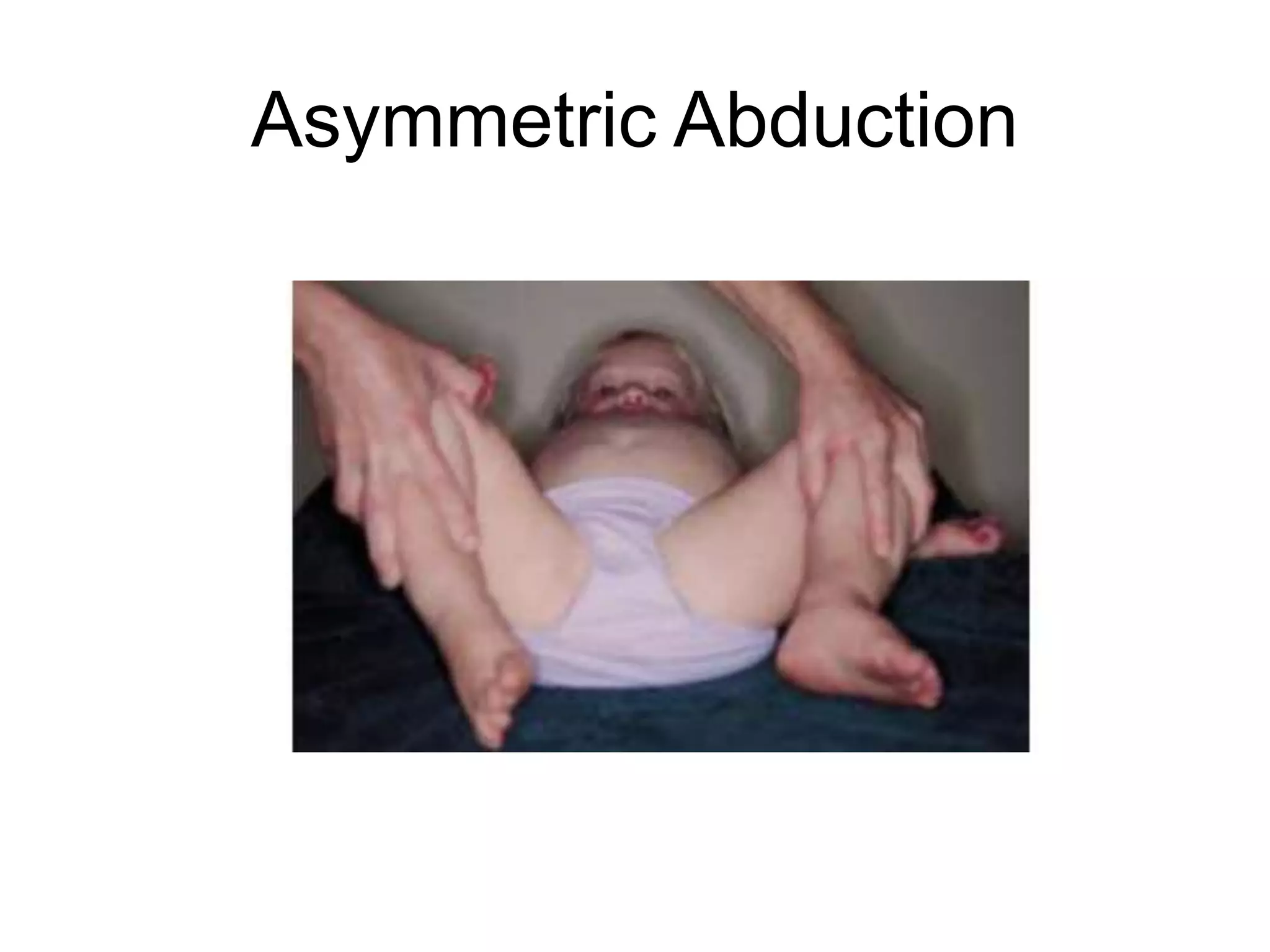 Asymmetric Abduction
 