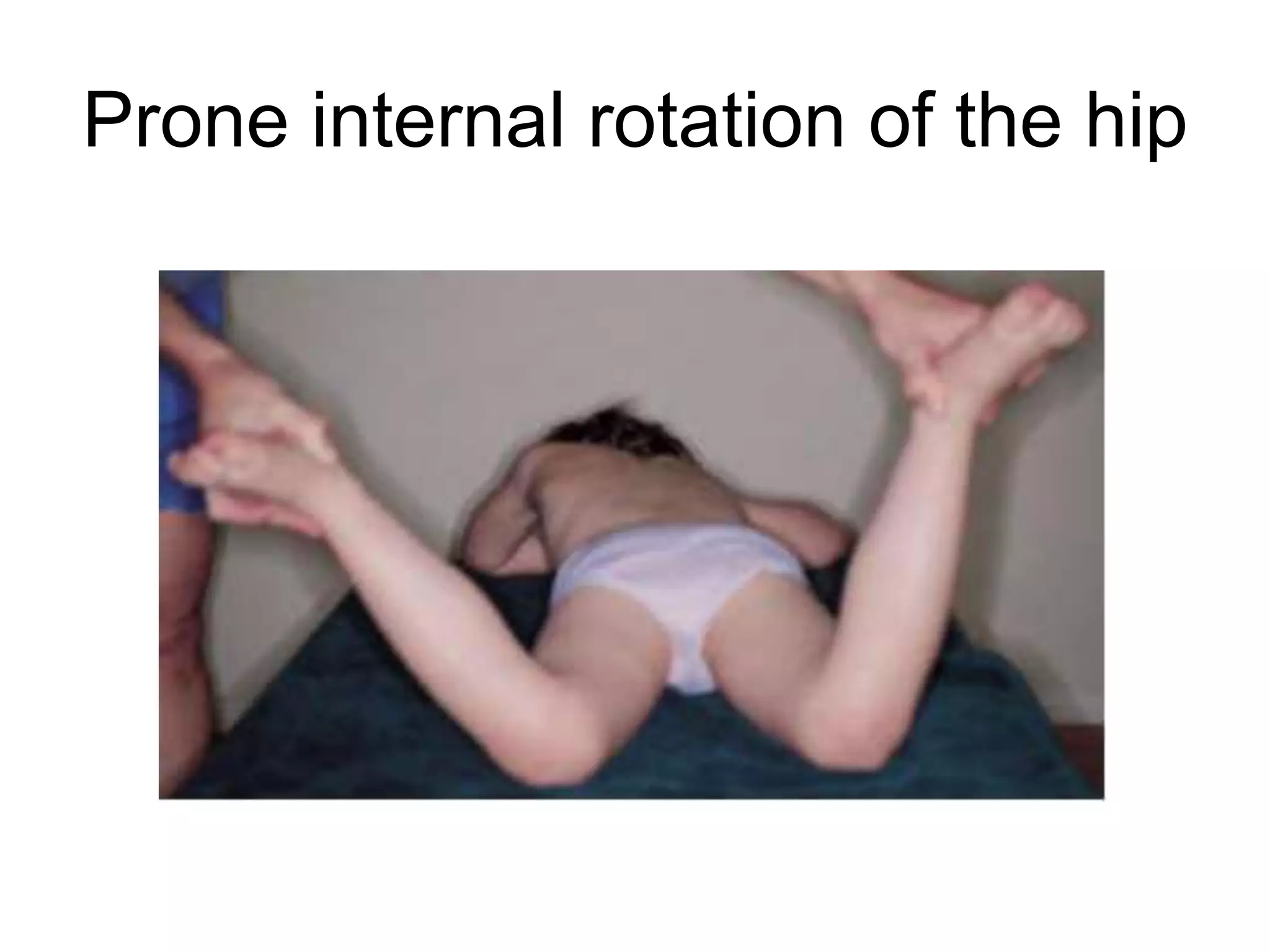 Prone internal rotation of the hip
 