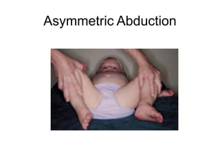 Asymmetric Abduction
 