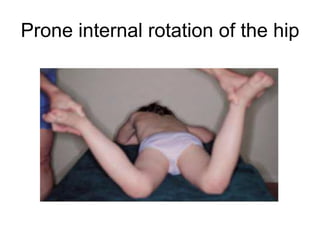 Prone internal rotation of the hip
 