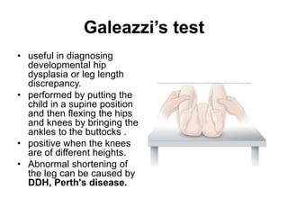 Galeazzi’s test
• useful in diagnosing
developmental hip
dysplasia or leg length
discrepancy.
• performed by putting the
child in a supine position
and then flexing the hips
and knees by bringing the
ankles to the buttocks .
• positive when the knees
are of different heights.
• Abnormal shortening of
the leg can be caused by
DDH, Perth's disease.
 