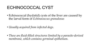 ECHINOCOCCAL CYST
• Echinococcal (hydatid) cysts of the liver are caused by
the larval form of Echinococcus granulosus
• Usually acquired from infected dogs.
• These are fluid-filled structures limited by a parasite-derived
membrane, which contains germinal epithelium.
 