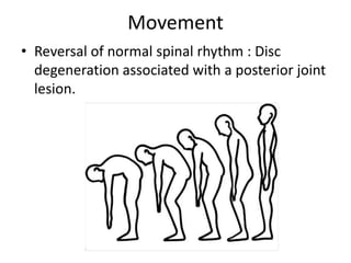 Approach to low back pain | PPTX