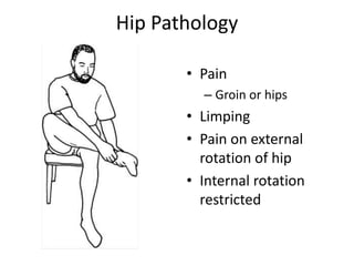 Approach to low back pain | PPTX