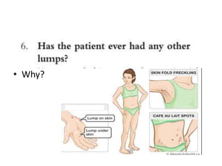 Approach to lump | PPTX
