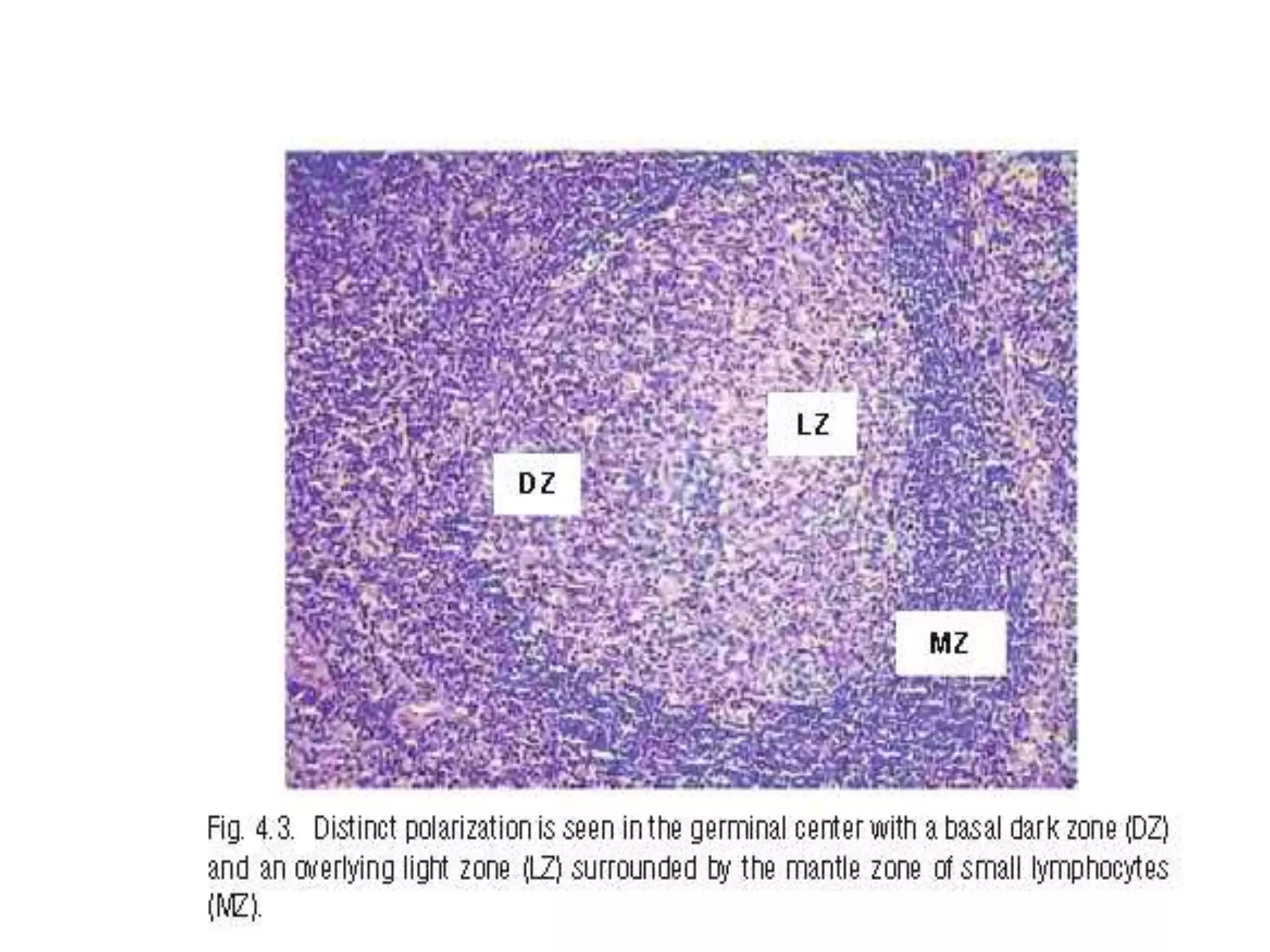 Approach To Lymphnode Pathology Pptx