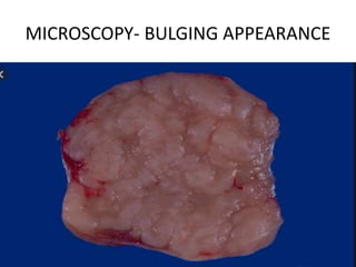 MICROSCOPY- BULGING APPEARANCE
 