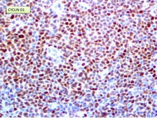 CYCLIN D1
 