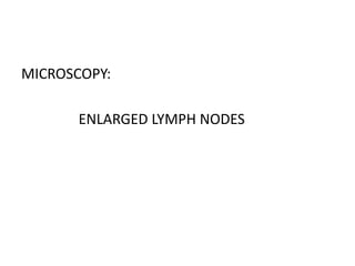 MICROSCOPY:
ENLARGED LYMPH NODES
 