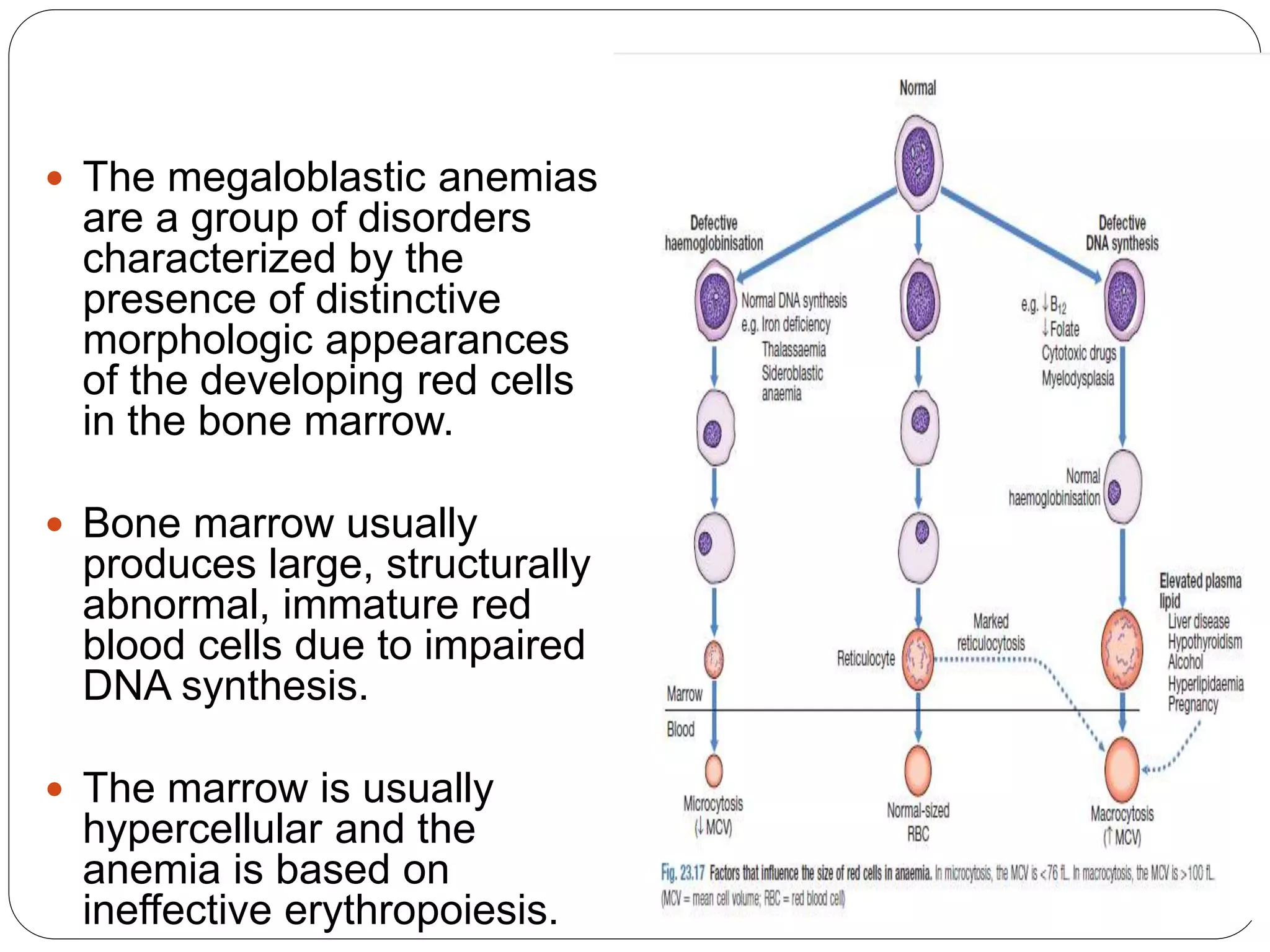  The megaloblastic anemias
are a group of disorders
characterized by the
presence of distinctive
morphologic appearances
of the developing red cells
in the bone marrow.
 Bone marrow usually
produces large, structurally
abnormal, immature red
blood cells due to impaired
DNA synthesis.
 The marrow is usually
hypercellular and the
anemia is based on
ineffective erythropoiesis.
 