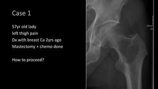 Case 1
57yr old lady
left thigh pain
Dx with breast Ca 2yrs ago
Mastectomy + chemo done
How to proceed?
 