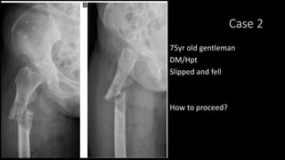 Case 2
75yr old gentleman
DM/Hpt
Slipped and fell
How to proceed?
 