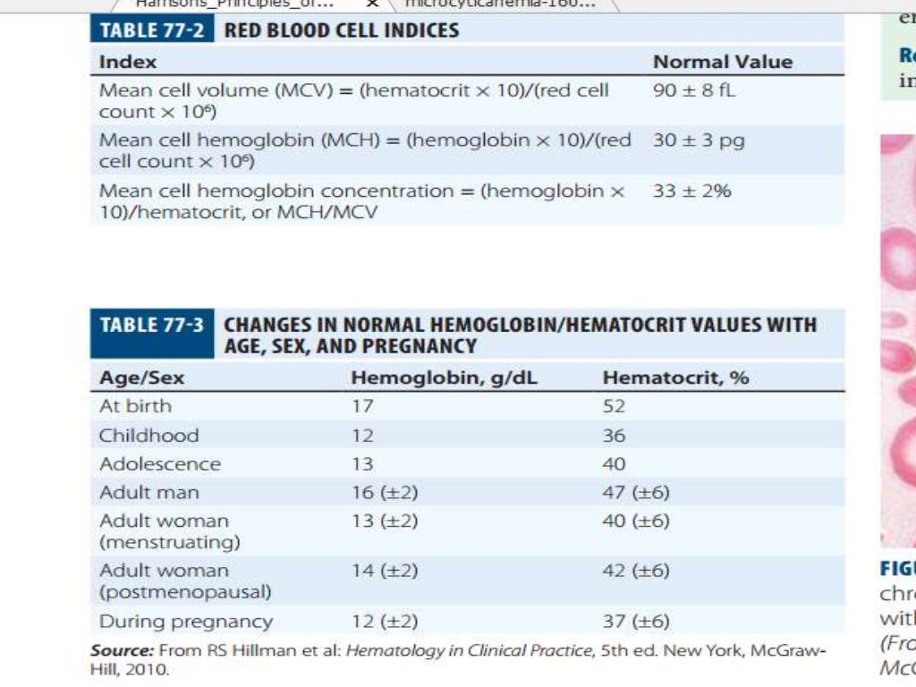 Approach to microcytic hypochromic anemia