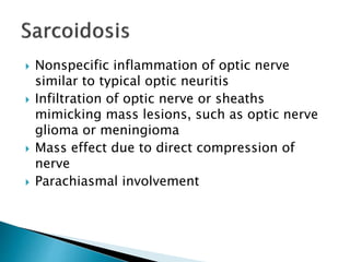  Nonspecific inflammation of optic nerve
similar to typical optic neuritis
 Infiltration of optic nerve or sheaths
mimicking mass lesions, such as optic nerve
glioma or meningioma
 Mass effect due to direct compression of
nerve
 Parachiasmal involvement
 