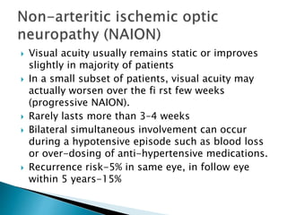  Visual acuity usually remains static or improves
slightly in majority of patients
 In a small subset of patients, visual acuity may
actually worsen over the fi rst few weeks
(progressive NAION).
 Rarely lasts more than 3–4 weeks
 Bilateral simultaneous involvement can occur
during a hypotensive episode such as blood loss
or over-dosing of anti-hypertensive medications.
 Recurrence risk-5% in same eye, in follow eye
within 5 years-15%
 