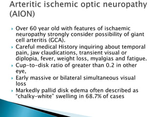  Over 60 year old with features of ischaemic
neuropathy strongly consider possibility of giant
cell arteritis (GCA).
 Careful medical History inquiring about temporal
pain, jaw claudications, transient visual or
diplopia, fever, weight loss, myalgias and fatigue.
 Cup-to-disk ratio of greater than 0.2 in other
eye,
 Early massive or bilateral simultaneous visual
loss
 Markedly pallid disk edema often described as
“chalky-white” swelling in 68.7% of cases
 