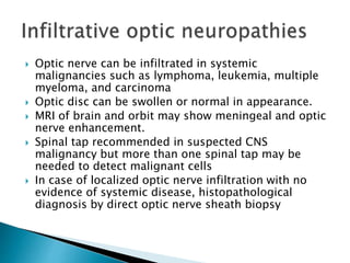  Optic nerve can be infiltrated in systemic
malignancies such as lymphoma, leukemia, multiple
myeloma, and carcinoma
 Optic disc can be swollen or normal in appearance.
 MRI of brain and orbit may show meningeal and optic
nerve enhancement.
 Spinal tap recommended in suspected CNS
malignancy but more than one spinal tap may be
needed to detect malignant cells
 In case of localized optic nerve infiltration with no
evidence of systemic disease, histopathological
diagnosis by direct optic nerve sheath biopsy
 