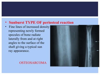 Approach to musculoskeletal neoplasms | PPT