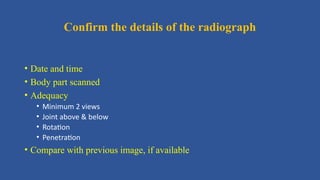 Roberts View Radiographs Approach_to_musculoskeletal_radiographs-2.pptx