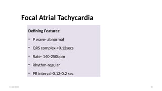 Sec Complex Approach_to_Narrow_QRS_Complex_Tachycardia_Naga_pptx_seminar (2).pptx