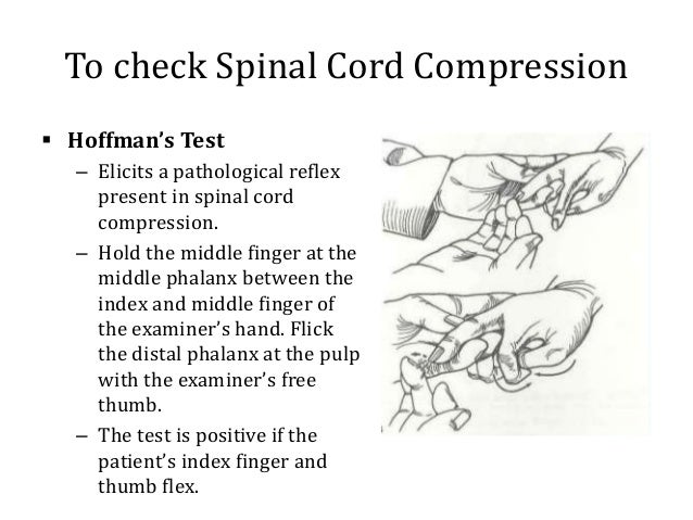 Approach To Neck Pain Approach To Neck Pain