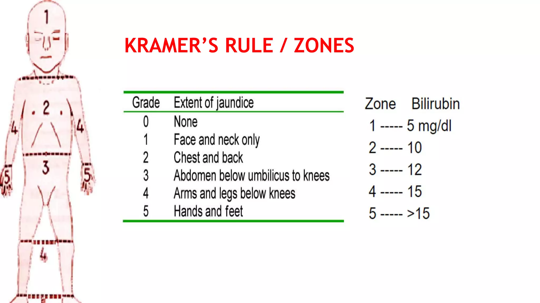 Approach to neonatal jaundice
