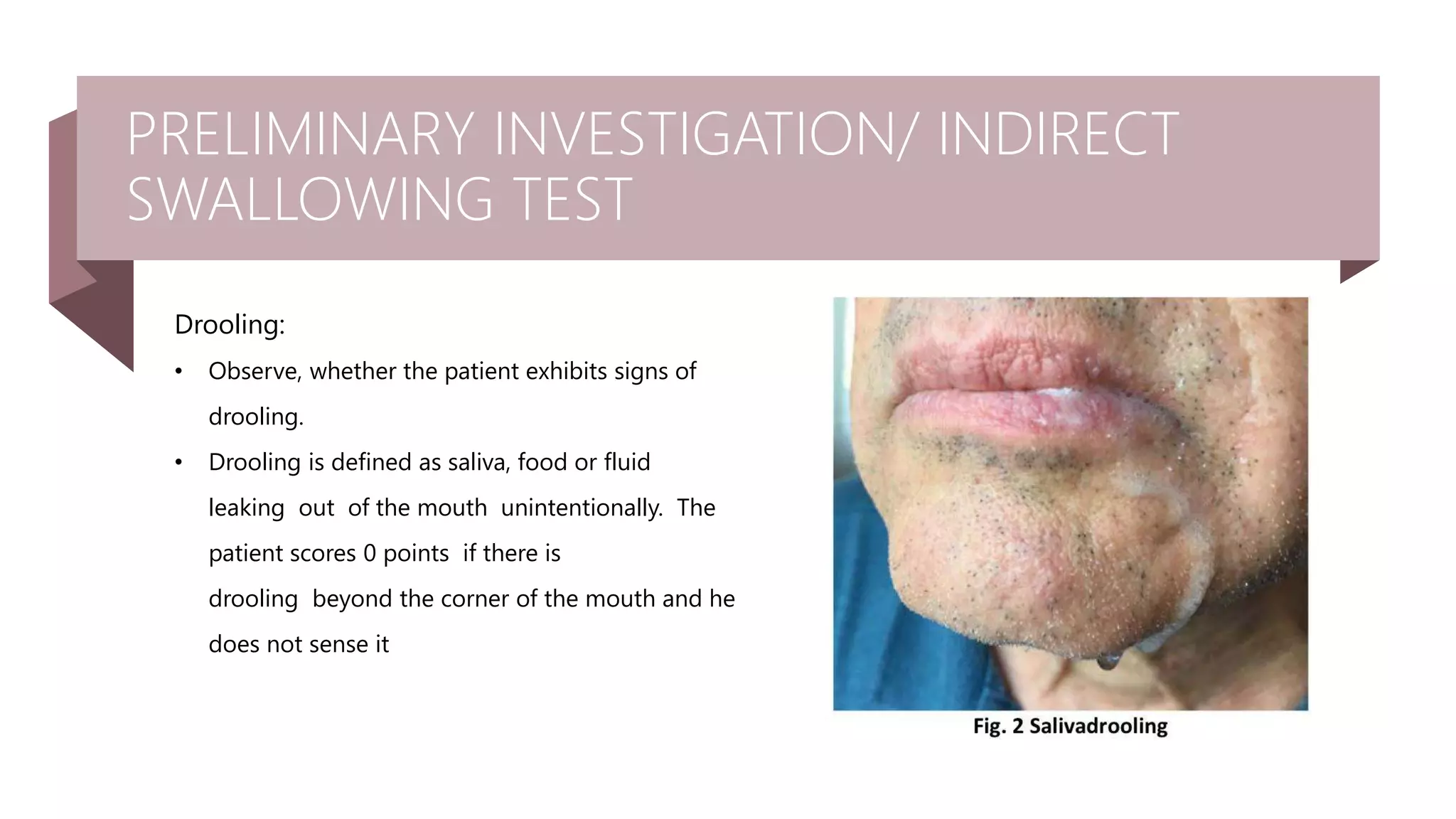 Define Drooling Approach to Neurogenic Dysphagia (1) 24_07.pptx