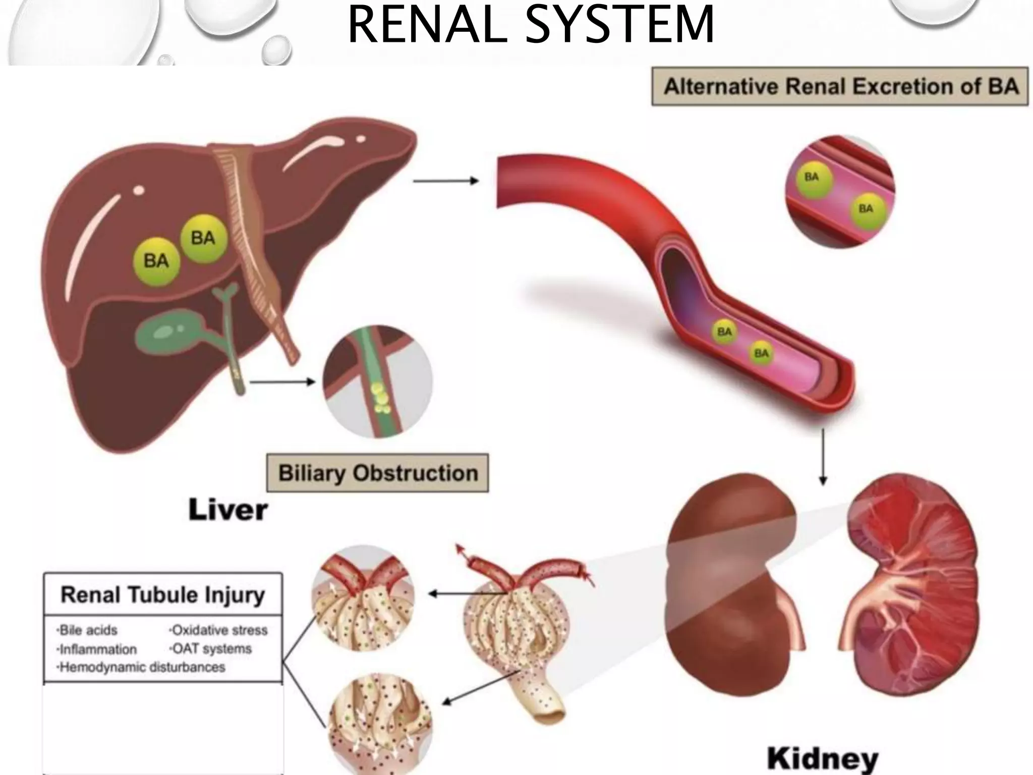 RENAL SYSTEM
AKI
 