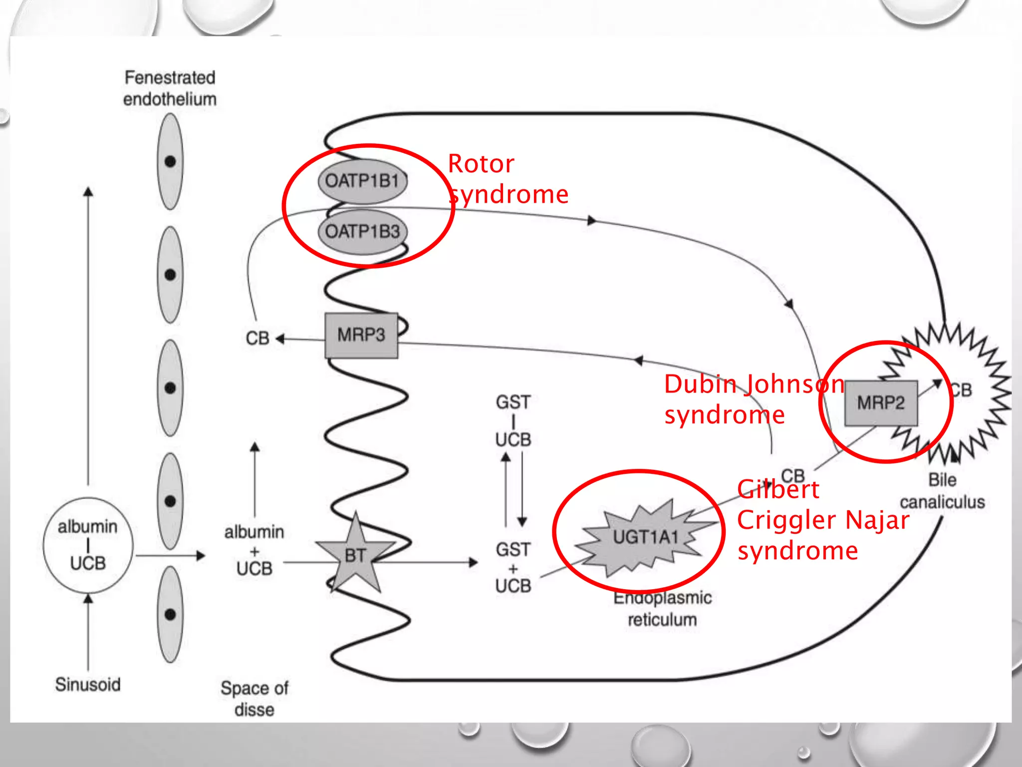 Rotor
syndrome
Dubin Johnson
syndrome
Gilbert
Criggler Najar
syndrome
 
