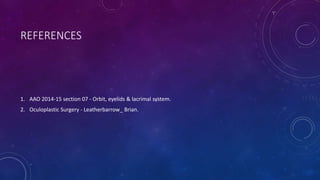 REFERENCES
1. AAO 2014-15 section 07 - Orbit, eyelids & lacrimal system.
2. Oculoplastic Surgery - Leatherbarrow_ Brian.
 