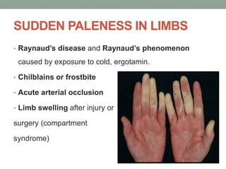 SUDDEN PALENESS IN LIMBS
• Raynaud’s disease and Raynaud’s phenomenon
caused by exposure to cold, ergotamin.
• Chilblains or frostbite
• Acute arterial occlusion
• Limb swelling after injury or
surgery (compartment
syndrome)
 