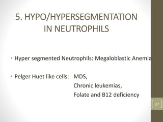 5. HYPO/HYPERSEGMENTATION
IN NEUTROPHILS
• Hyper segmented Neutrophils: Megaloblastic Anemia
• Pelger Huet like cells: MDS,
Chronic leukemias,
Folate and B12 deficiency.
27
 