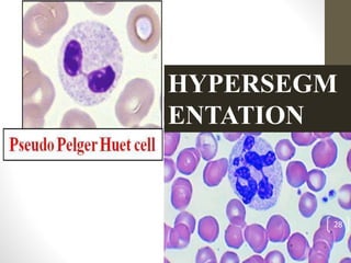 HYPERSEGM
ENTATION
28
 