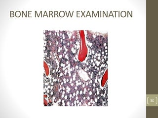 BONE MARROW EXAMINATION
30
 