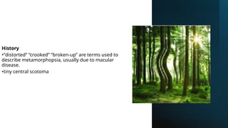History
•“distorted” “crooked” “broken-up” are terms used to
describe metamorphopsia, usually due to macular
disease.
•tiny central scotoma
 