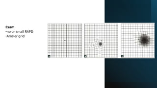 Exam
•no or small RAPD
•Amsler grid
 