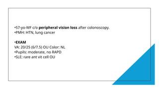 •57-yo-WF c/o peripheral vision loss after colonoscopy.
•PMH: HTN, lung cancer
•EXAM
VA: 20/25 (6/7.5) OU Color: NL
•Pupils: moderate, no RAPD
•SLE: rare ant vit cell OU
 
