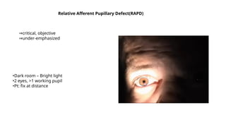 Relative Afferent Pupillary Defect(RAPD)
⇒critical, objective
⇒under-emphasized
•Dark room – Bright light
•2 eyes, >1 working pupil
•Pt: fix at distance
 