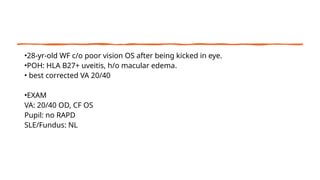 •28-yr-old WF c/o poor vision OS after being kicked in eye.
•POH: HLA B27+ uveitis, h/o macular edema.
• best corrected VA 20/40
•EXAM
VA: 20/40 OD, CF OS
Pupil: no RAPD
SLE/Fundus: NL
 
