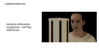 2. Bilateral Vision Loss
•observe ambulation
•sunglasses – red flag
•OKN drum
 