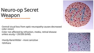Neuro-op Secret
Weapon
Central visual loss from optic neuropathy causes decreased
color vision!
Color not affected by refraction, media, retinal disease
unless acuity < 20/200 (6/60).
•Hardy-Rand-Rittler - more sensitive
•Ishihara
 