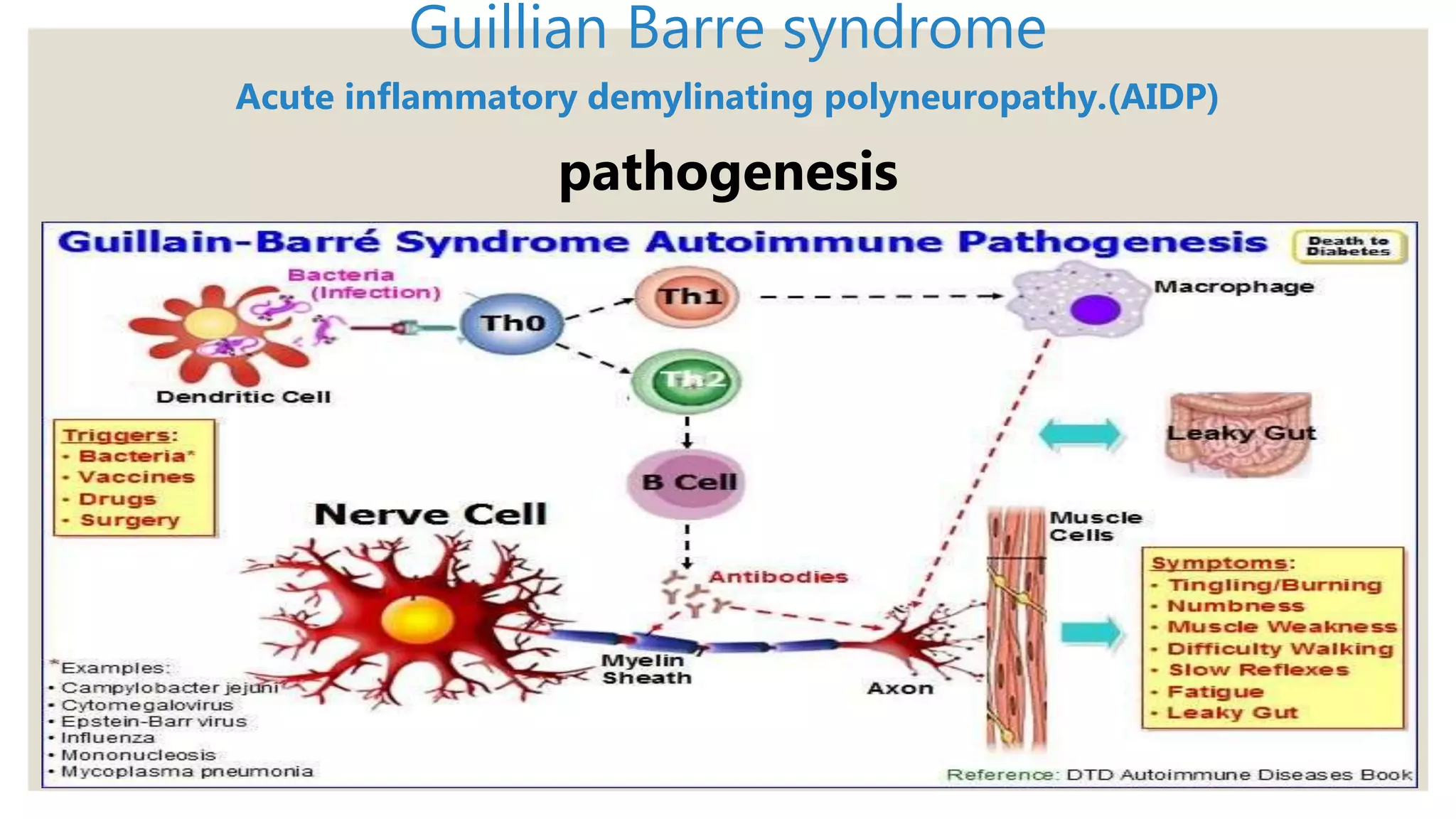 Guillian Barre syndrome
Acute inflammatory demylinating polyneuropathy.(AIDP)
pathogenesis
 